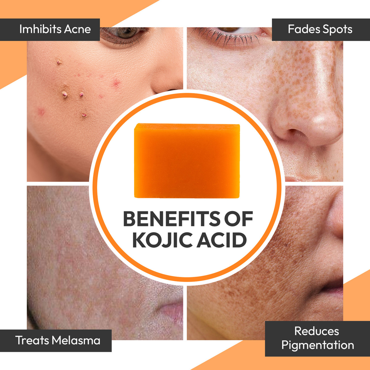 effect_of_Kojic_Acid_Soap__19612 ๐๐ผ๐ท๐ถ๐ฒ ๐ฆ๐ฎ๐ป ๐ฆ๐ธ๐ถ๐ป ๐๐ถ๐ด๐ต๐๐ฒ๐ป๐ถ๐ป๐ด ๐๐ผ๐ท๐ถ๐ฐ ๐๐ฐ๐ถ๐ฑ ๐ฆ๐ผ๐ฎ๐ฝ - Image 5